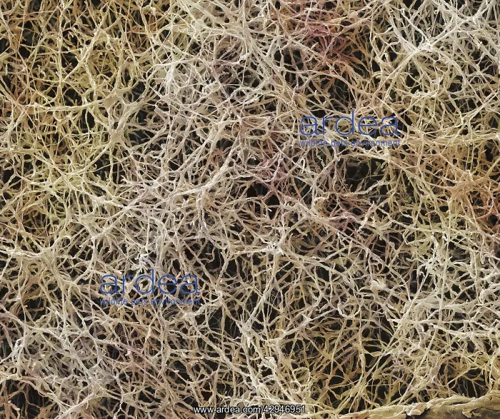 : AthleteIs Foot Fungus : AthleteIs Foot Fungus