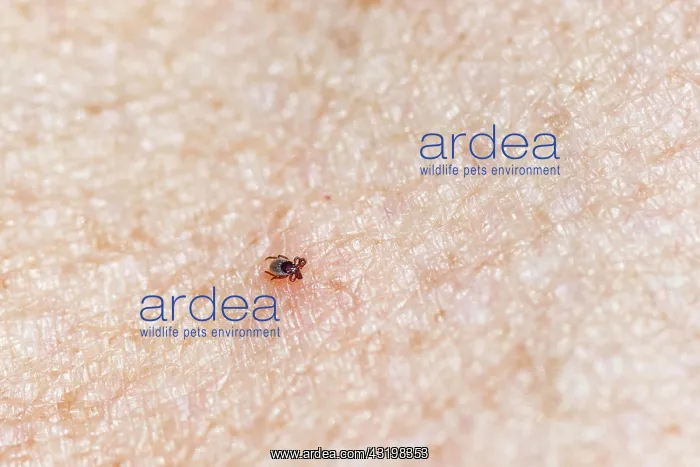 : Castor Bean Tick (Ixodes ricinus), tick on human : Castor Bean Tick (Ixodes ricinus), tick on human