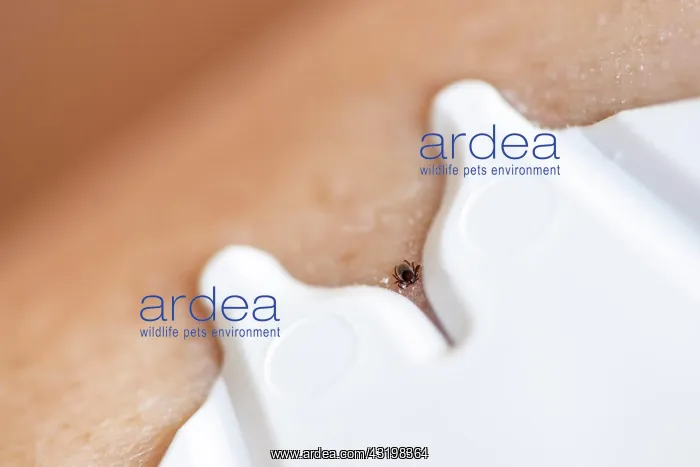 : Castor Bean Tick (Ixodes ricinus), tick on human : Castor Bean Tick (Ixodes ricinus), tick on human