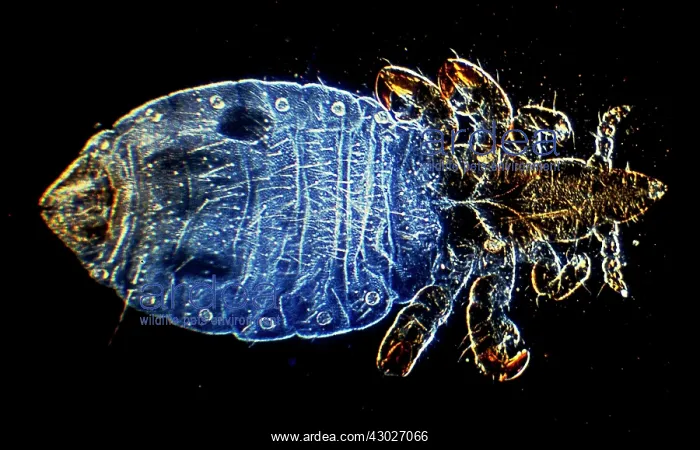 : Dark Field Light Micrograph Human Head Louse : Dark Field Light Micrograph Human Head Louse