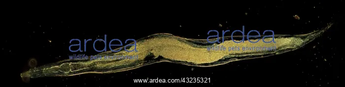 : Dark Field Light Micrograph (LM): Human Pinworm : Dark Field Light Micrograph (LM): Human Pinworm