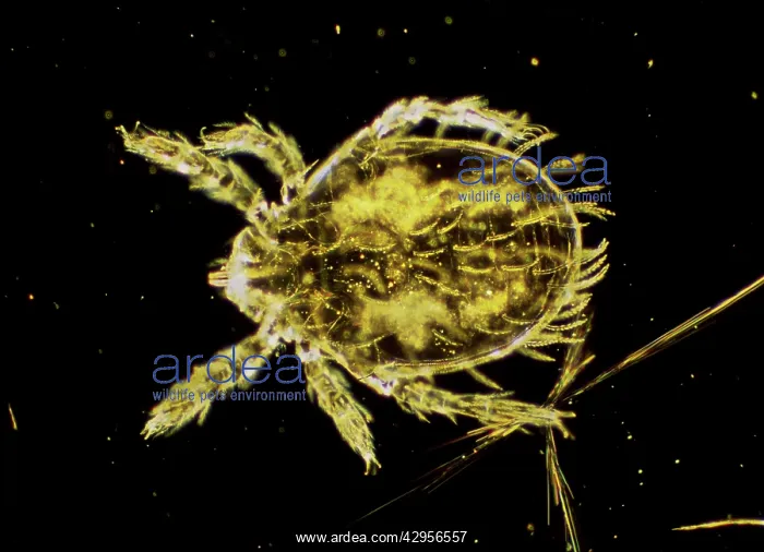 : Dark Field Light Micrograph: Scrub Typhus Mite Chigger : Dark Field Light Micrograph: Scrub Typhus Mite Chigger