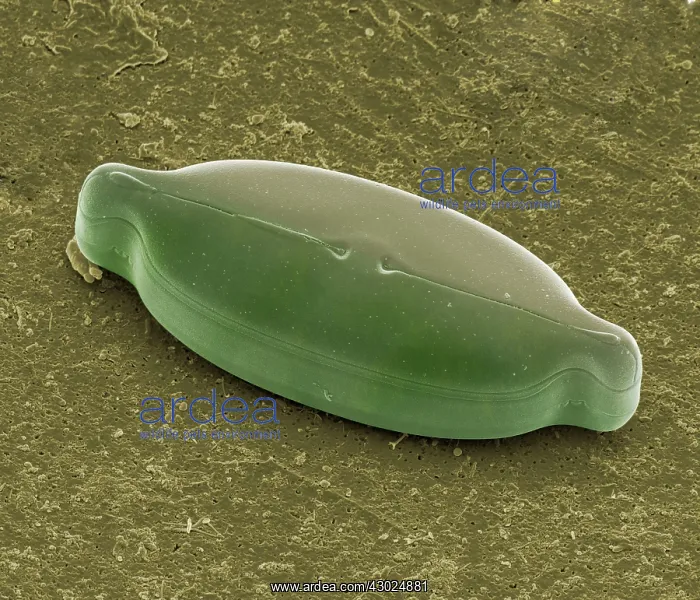 : Diatom Scanning Electron Micrograph (SEM): Magnification x5275 (if print A4 size : Diatom Scanning Electron Micrograph (SEM): Magnification x5275 (if print A4 size