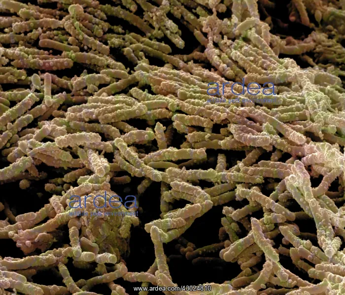 : Escherishia Coli Bacteria / E. Coli - affected by antibiotic : Escherishia Coli Bacteria / E. Coli - affected by antibiotic