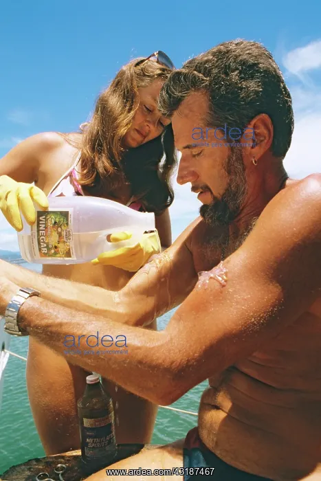  : First aid treatment for sting of Box jellyfish (Chironex