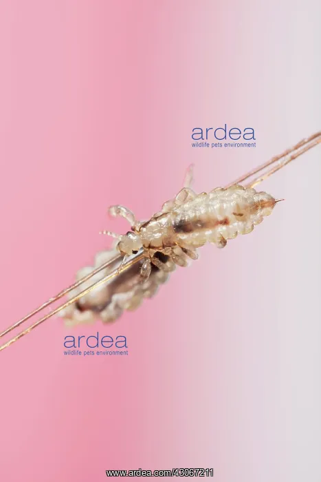 : Head lices ( Pediculus humanus capitis ) clinging : Head lices ( Pediculus humanus capitis ) clinging