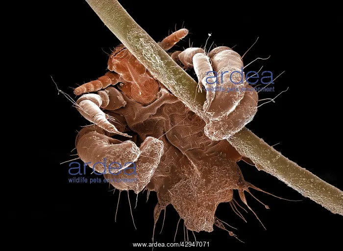 : Human Crab Louse : Human Crab Louse