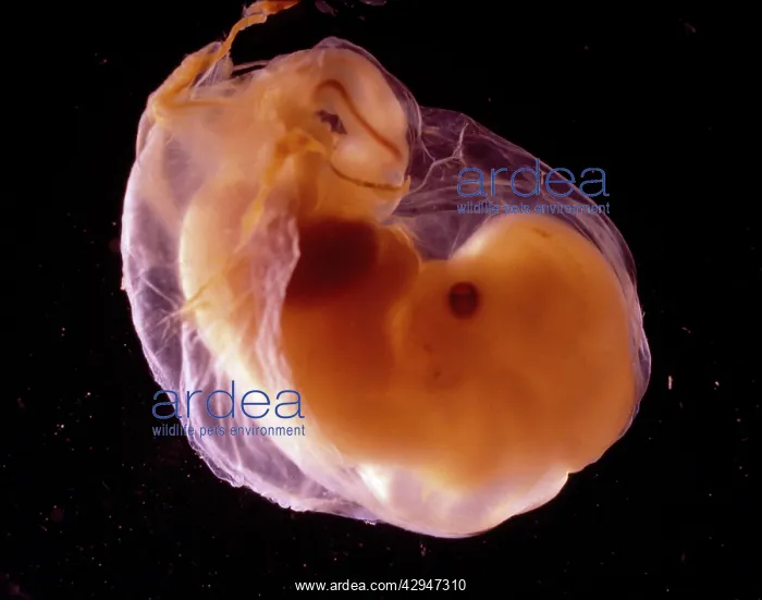 : Human Embryo : Human Embryo