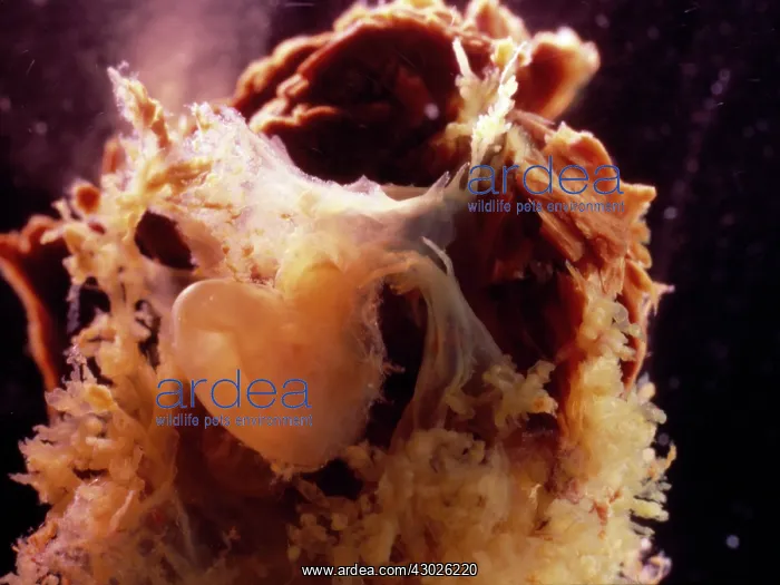 : Human Embryo With Placenta : Human Embryo With Placenta