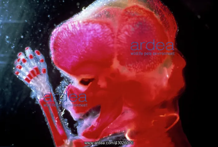 : Human Foetus - red dye to show bones : Human Foetus - red dye to show bones