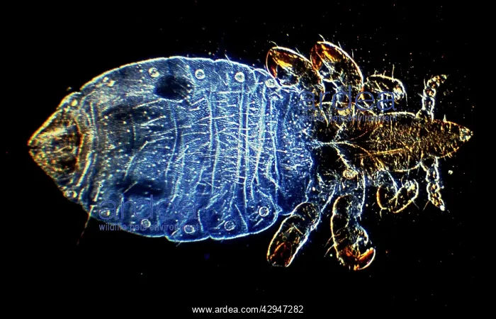 : Human Head Louse : Human Head Louse