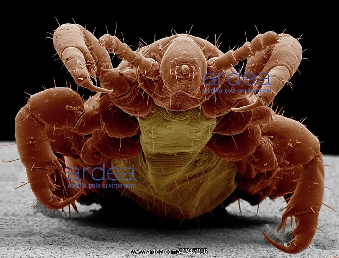 : Human Head Louse : Human Head Louse