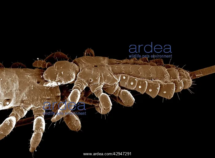 : Human Head Louse : Human Head Louse