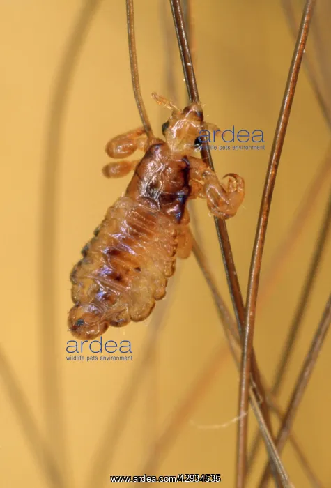: Human Head Louse - on hair : Human Head Louse - on hair