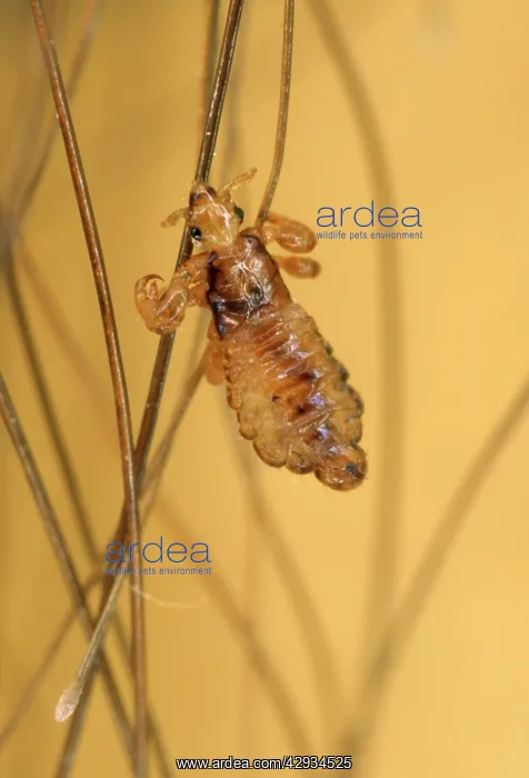 : Human Head Louse - on human child hair : Human Head Louse - on human child hair