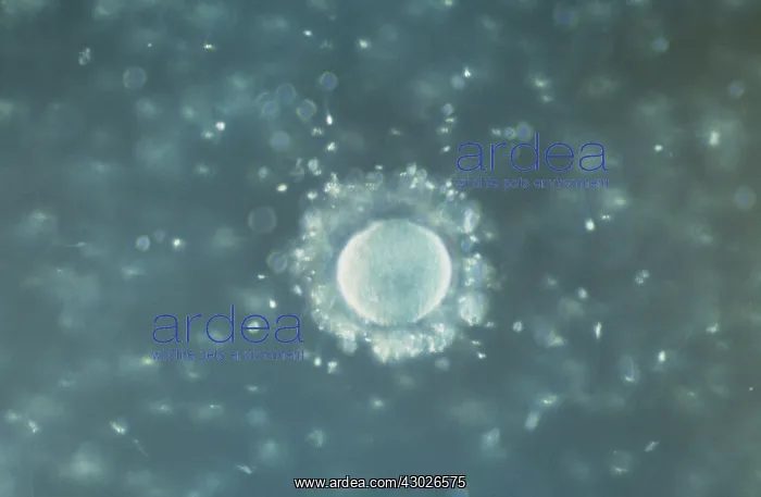 : A human Ovum surrounded by Sperm - being fertilized : A human Ovum surrounded by Sperm - being fertilized
