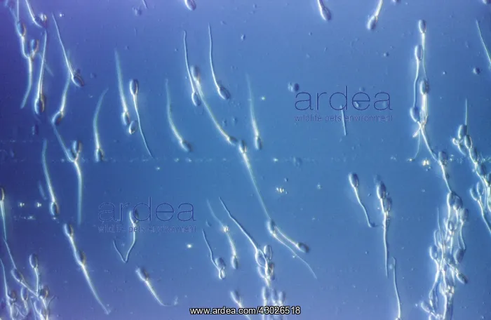: Human Sperm : Human Sperm