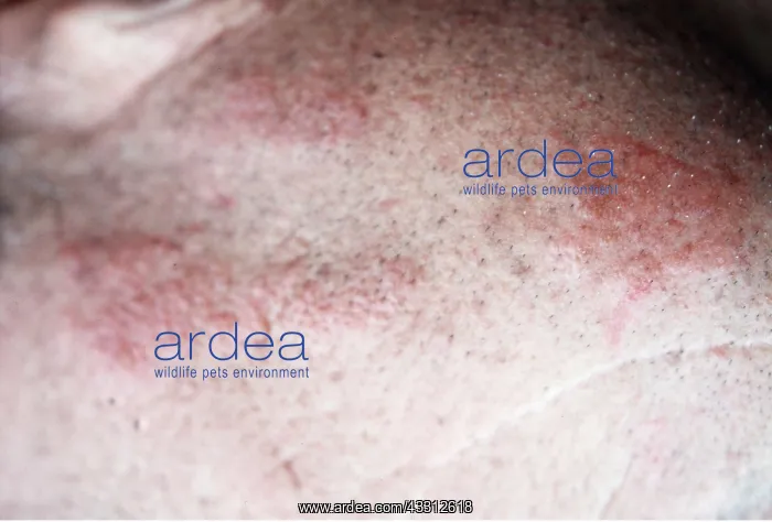 : JELLYFISH - Welts on divers face after contact : JELLYFISH - Welts on divers face after contact