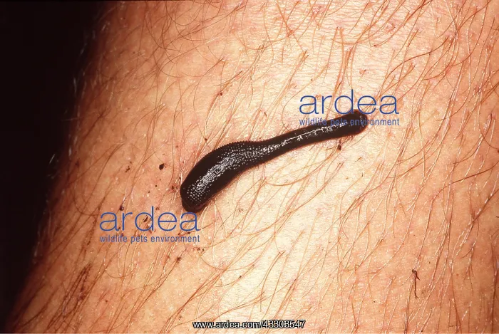: LEECH ON LEG - feeding from human host : LEECH ON LEG - feeding from human host