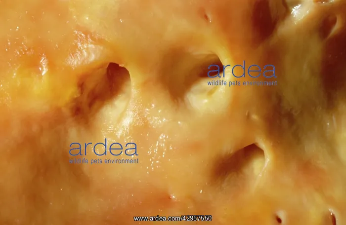 : Light Micrograph of Atherosclerotic Aorta Vessel : Light Micrograph of Atherosclerotic Aorta Vessel