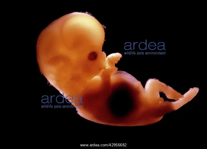 : Light Micrograph of Human Foetus 10-11 weeks after : Light Micrograph of Human Foetus 10-11 weeks after