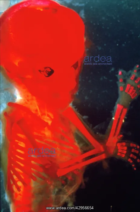 : Light Micrograph of Human Foetus 12 weeks - red : Light Micrograph of Human Foetus 12 weeks - red