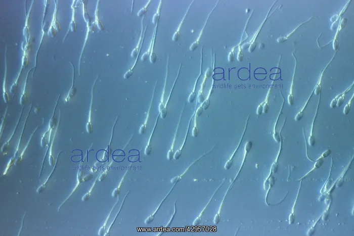 : Light Micrograph of Human Sperm : Light Micrograph of Human Sperm