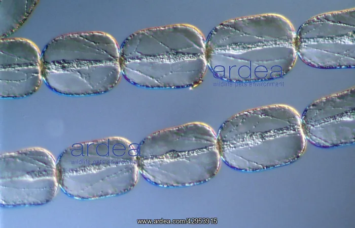: Light Micrograph (LM): Cells from a hair on the : Light Micrograph (LM): Cells from a hair on the