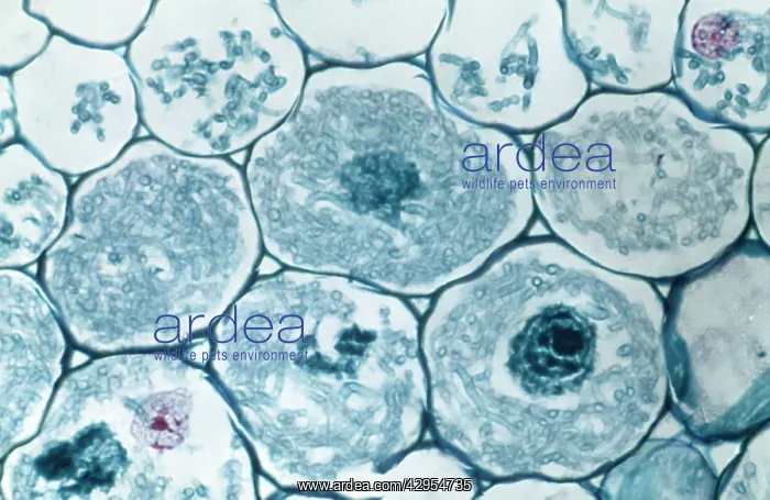  : Light Micrograph (LM): Filaments of fungi Endotrophic