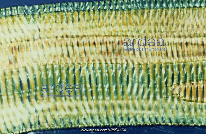 : Light Micrograph (LM): Longitudinal section shows : Light Micrograph (LM): Longitudinal section shows