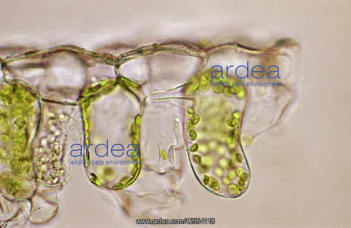 : Light Micrograph (LM): plant cell chloroplasts : Light Micrograph (LM): plant cell chloroplasts