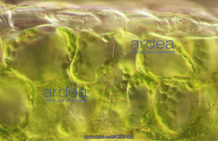 : Light Micrograph (LM): plant cell chloroplasts : Light Micrograph (LM): plant cell chloroplasts