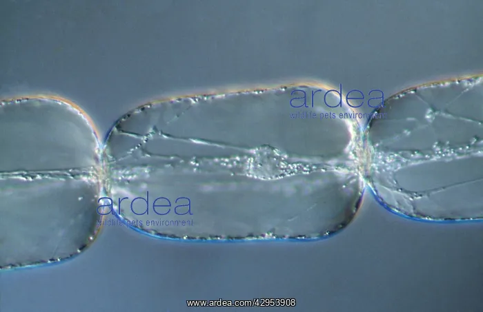 : Light Micrograph (LM): A single cell from a hair : Light Micrograph (LM): A single cell from a hair