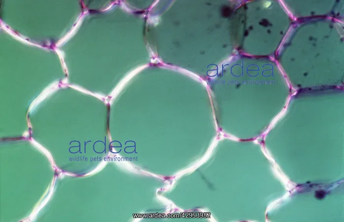 : Light Micrograph (LM): transverse section shows : Light Micrograph (LM): transverse section shows