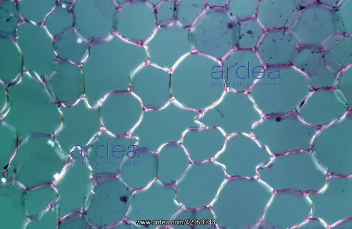 : Light Micrograph (LM): tranverse section shows : Light Micrograph (LM): tranverse section shows