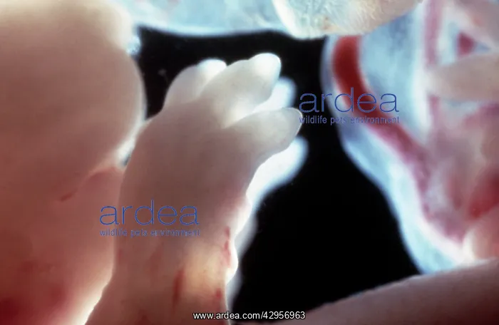 : Light Micrograph of Rat Embryo - The paws of a 17.5 day old : Light Micrograph of Rat Embryo - The paws of a 17.5 day old