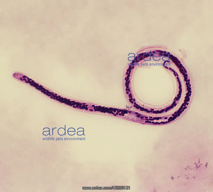 : Light Micrograph (SEM): Micro-filarial worm : Light Micrograph (SEM): Micro-filarial worm
