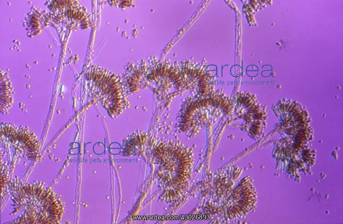 : Light Micrograph showing fruiting bodies (conidiophores) : Light Micrograph showing fruiting bodies (conidiophores)