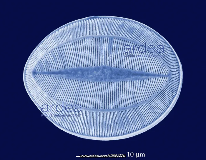 : Microalga - the micro-algae have very graphic forms. x 2500 : Microalga - the micro-algae have very graphic forms. x 2500