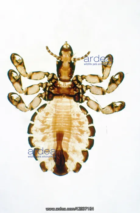  : Pig Louse - x5 magnification