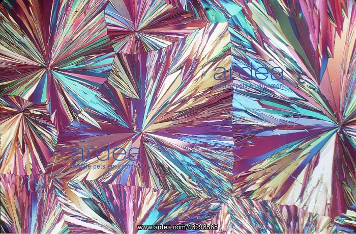 : POLARISED LIGHT - Hippuric acid x5 : POLARISED LIGHT - Hippuric acid x5