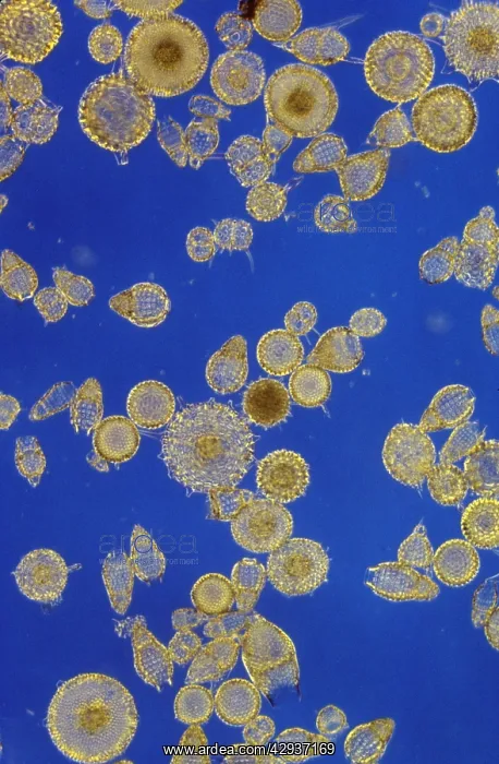 : Protozoa - Radiolarians (x20) Actinopoda : Protozoa - Radiolarians (x20) Actinopoda