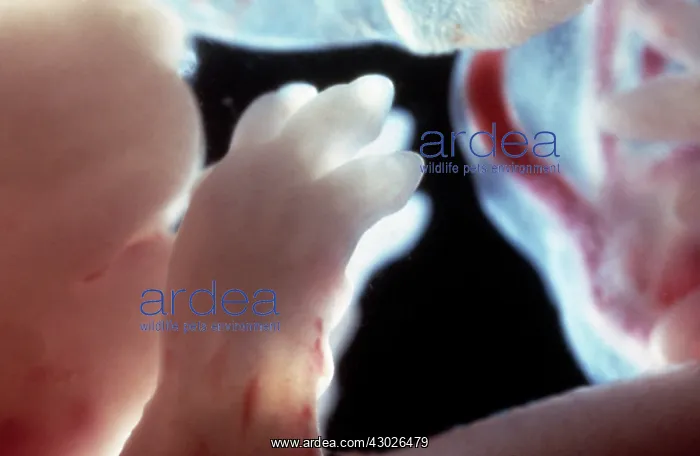 : Rat Embryo - The paws of a 17.5 day old rat embryo : Rat Embryo - The paws of a 17.5 day old rat embryo