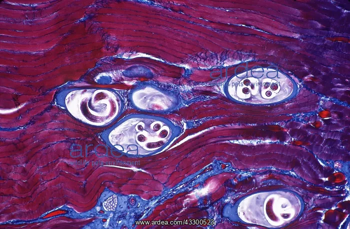 : ROUND WORM - Larval cysts of trichinells spiralis in muscle : ROUND WORM - Larval cysts of trichinells spiralis in muscle