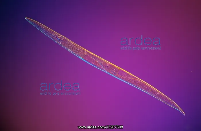 : Roundworm over 15, 000 known species in the genu : Roundworm over 15, 000 known species in the genu