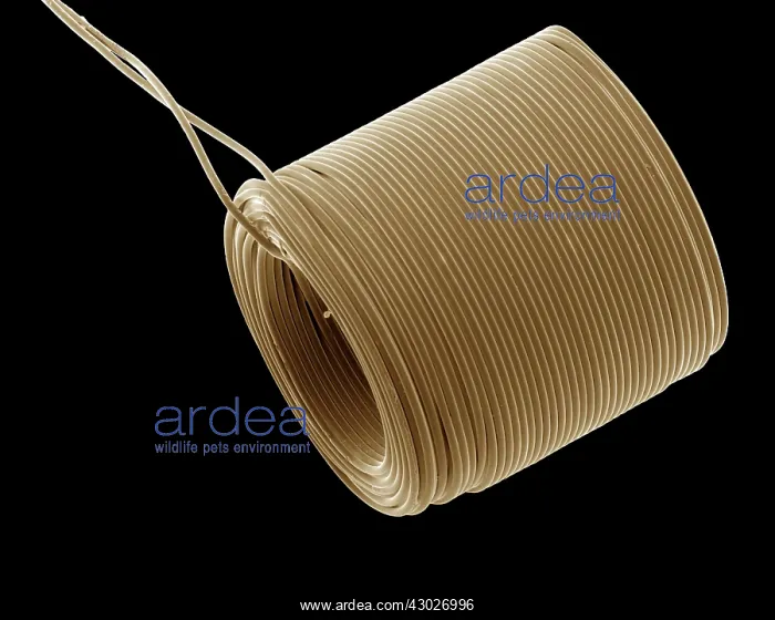 : Scanning Electron Micrograph (SEM); Catheter : Scanning Electron Micrograph (SEM); Catheter