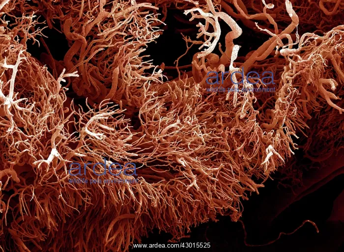 : Scanning Electron Micrograph (SEM): a corrosion : Scanning Electron Micrograph (SEM): a corrosion
