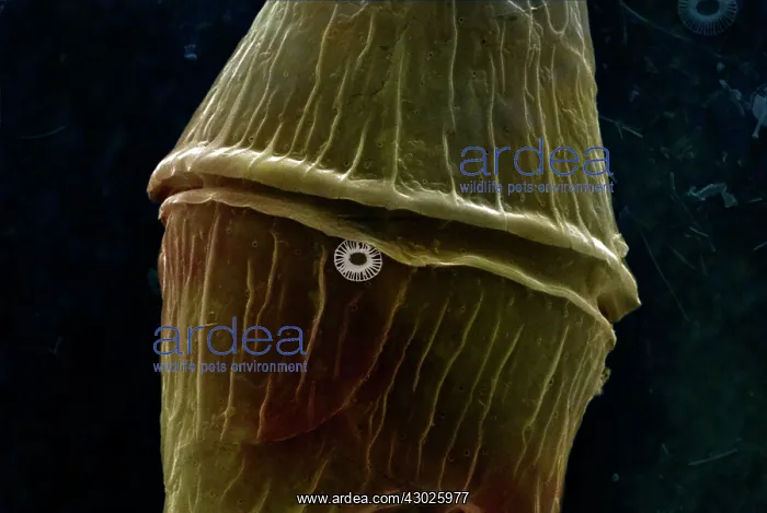 : Scanning Electron Micrograph (SEM): Dinoflagellate : Scanning Electron Micrograph (SEM): Dinoflagellate