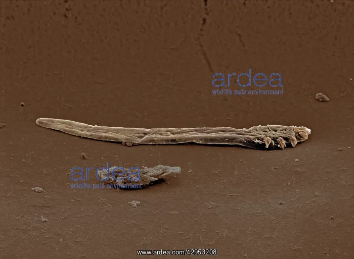 : Scanning Electron Micrograph (SEM): Follicle Mite : Scanning Electron Micrograph (SEM): Follicle Mite