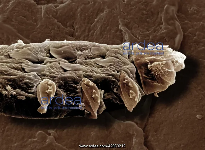  : Scanning Electron Micrograph (SEM): Follicle Mite
